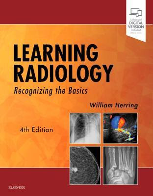 Learning Radiology: Recognizing the Basics PDF