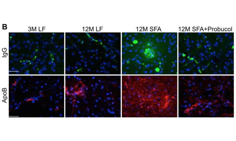 WA mutant mice breakthrough finds probable cause of Alzheimer’s disease