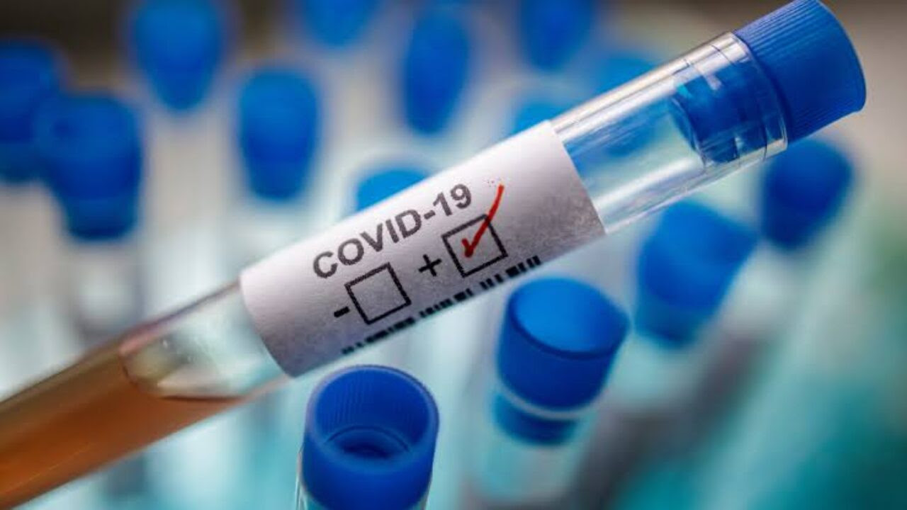 US surpasses 30 million coronavirus cases