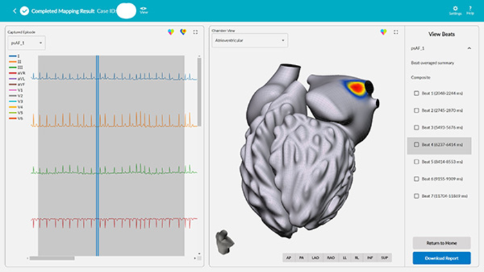 vMap Vektor Medical