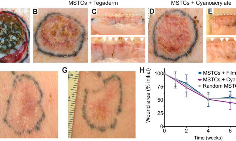 MagneTEskin – Reconstructing the skin with magnetically induced assembly of microtissue cores