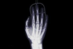 xray of a hand on a pc mouse