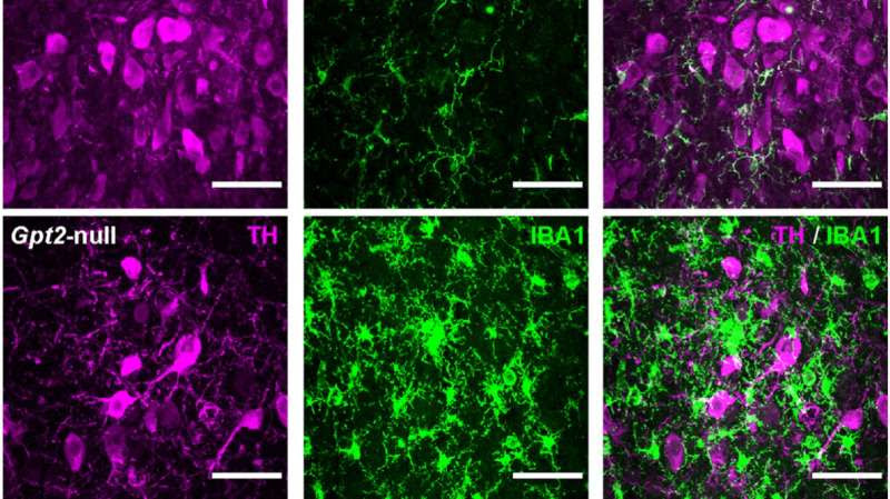 How a brain area implicated in Alzheimer’s may be vulnerable to degeneration