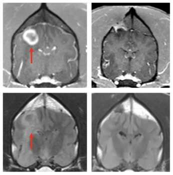 Possible viable treatment for human brain cancer