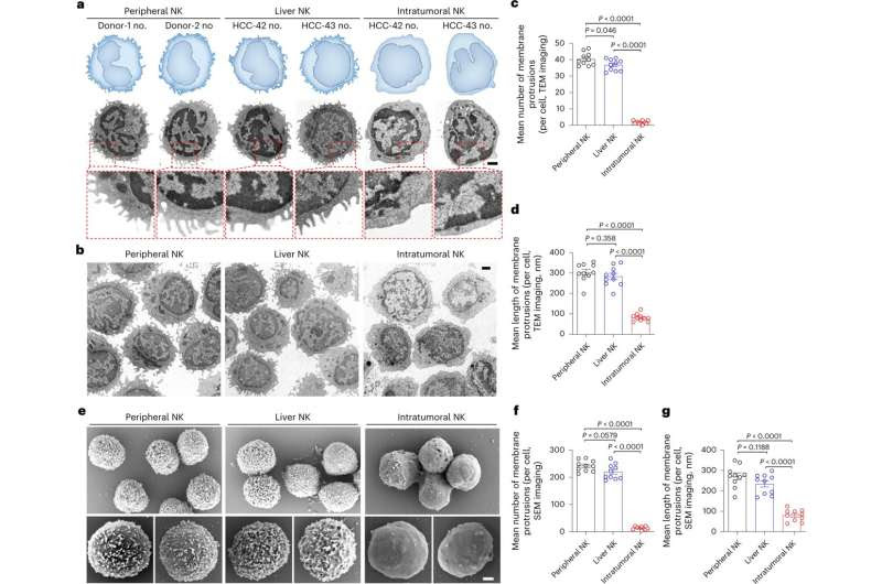 Researchers reveal key mechanism of natural killer cell dysfunction