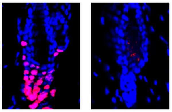 Hair-raising research: Scientists find surprising link between immune system, hair growth