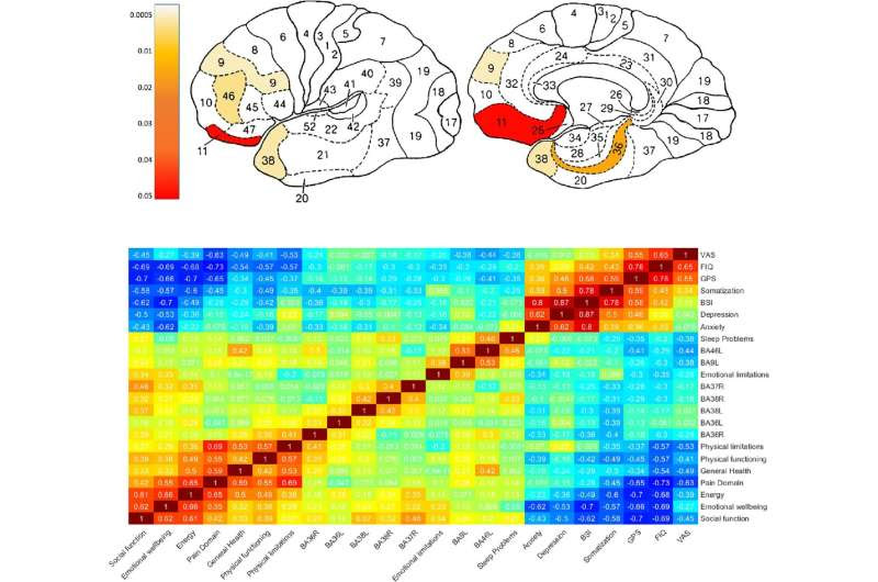 Dedicated protocol of hyperbaric oxygen therapy is more effective for fibromyalgia caused by head injury