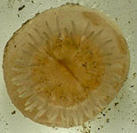 Onion anemone