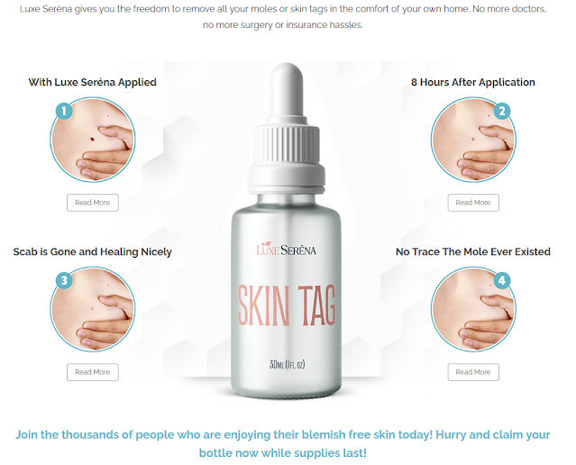 Luxe Serena Skin Tag Remover【 USA's Official Website】-A Secret Weapon for  Attain Moles, Tags & Warts Free Skin! | by Luxe Serena Skin Tag Remover |  May, 2024 | Medium