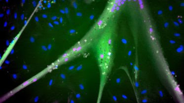 Immortalized Bovine Stem Cells Differentiate to Muscle Cells
