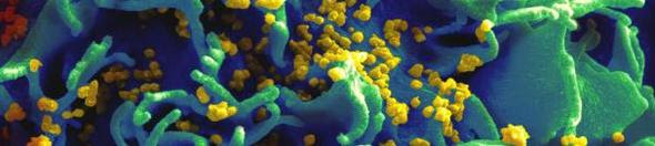 HIV-infected T cell