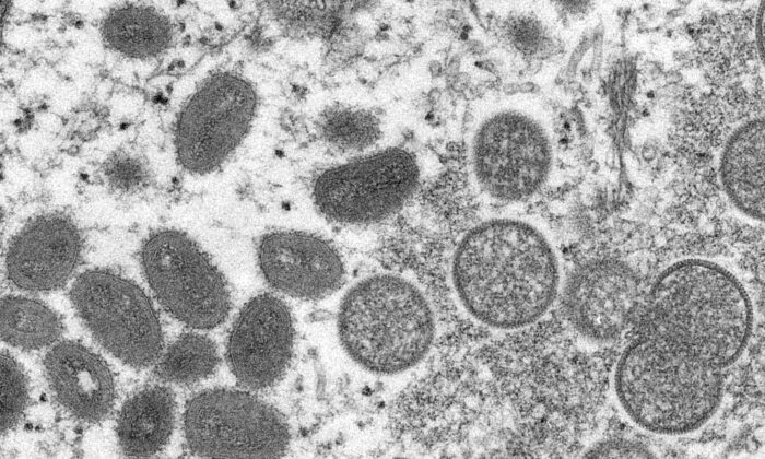 MONKEYPOX BREAKOUT: CDC Tells Doctors to Be on Alert for Monkeypox