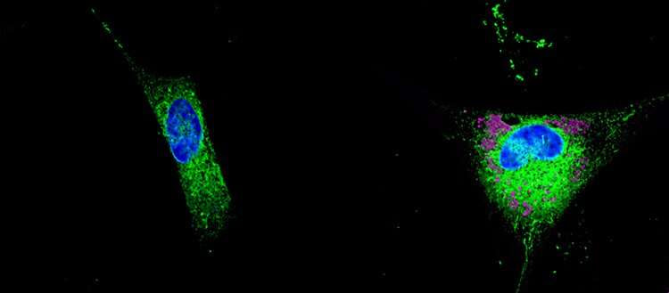 The role of lipids in the development of Alzheimer’s disease