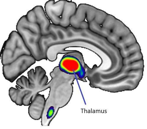 Nicotine dose in a single cigarette blocks estrogen production in women's brains