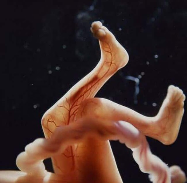 Những bức ảnh đáng kinh ngạc về sự phát triển của thai nhi trong bụng mẹ - 13