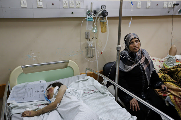 Palestinian Beisan Dhahir, 7, sleeps at Shifa hospital in Gaza City, late Sunday, July 20, 2014. Beisan's home was shelled and collapsed by Israel¿s military...