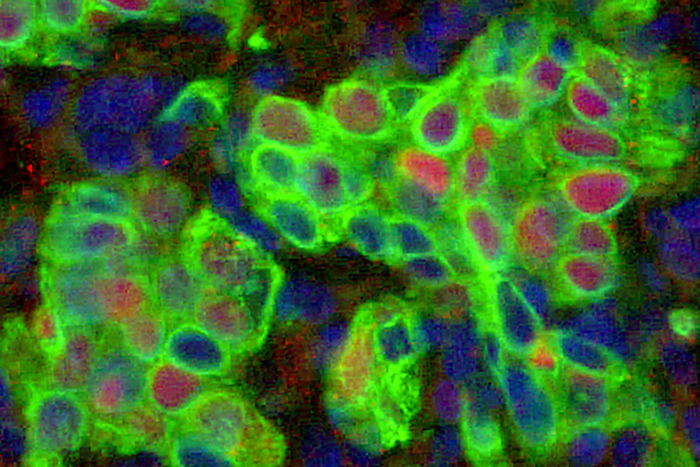 Basal epithelial stem cells in lung