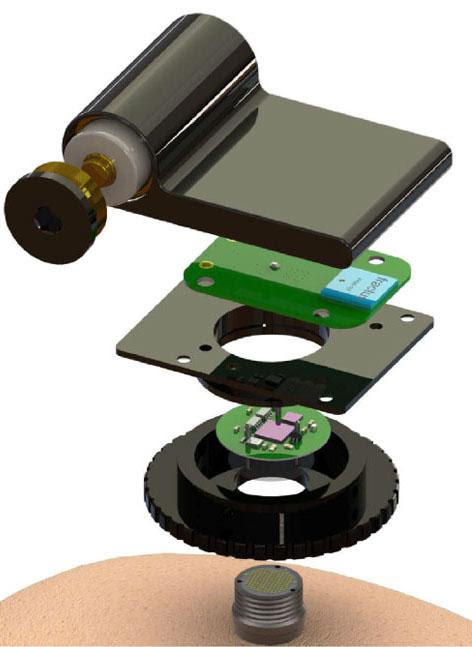 A schematic of the wireless transmitter developed by the BrainGate team