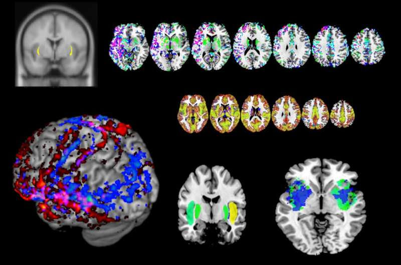 Brain area thought to impart consciousness, behaves instead like an Internet router