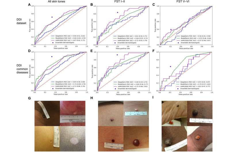 Training physicians and algorithms in dermatology diversity