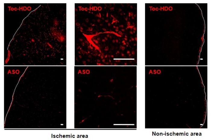 Distribution of IV-administered Toc-HDO in ischemic area and non-ischemic area