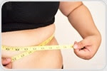 Weight loss surgery widely underutilized among young patients with severe obesity