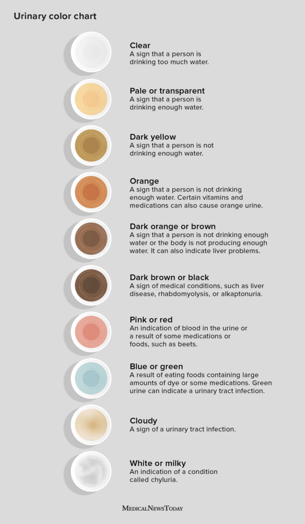 An illustration portraying the different colors of urine.