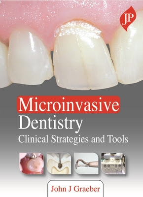 Microinvasive Dentistry: Clinical Strategies and Tools EPUB
