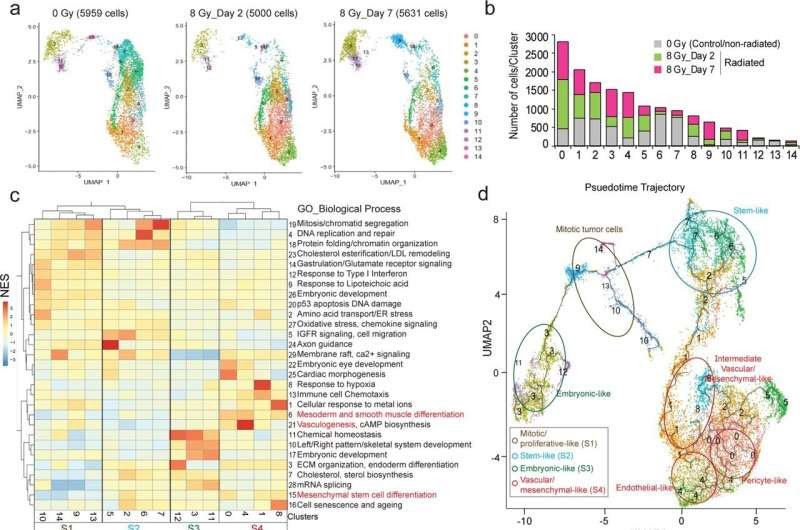 Researchers identify a gene as a potential target in treatment-resistant brain cancer glioblastoma multiforme