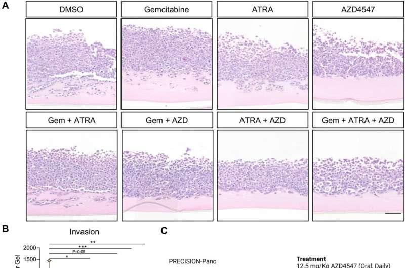 Research identifies new way to halt pancreatic cancer invasion by targeting healthy cells