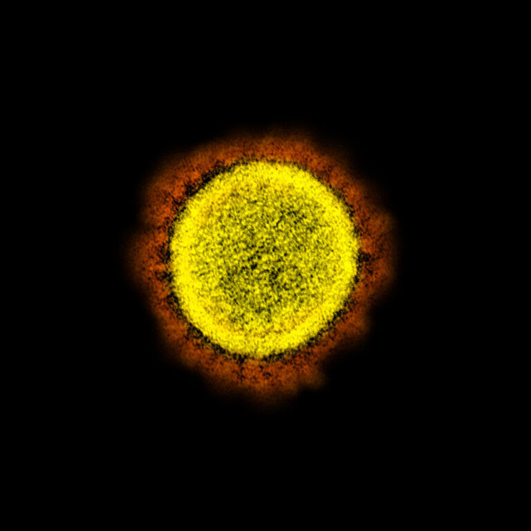Micrografía de SARS-CoV-2 (amarillo)