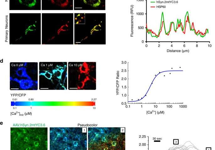 Researchers link high calcium levels in mitochondria to neuronal death in Alzheimer's disease