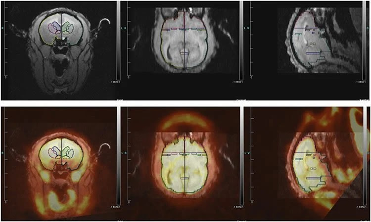 Image shows monkey brain scans