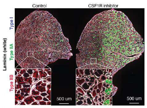 Cancer drug shows potential as treatment for muscular dystrophy