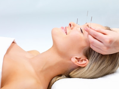 cosmeticAcupuncture1.JPG