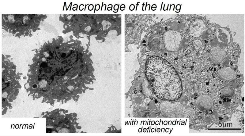 Spanish scientists identify a new therapeutic target in macrophages for the treatment of obesity-related diseases