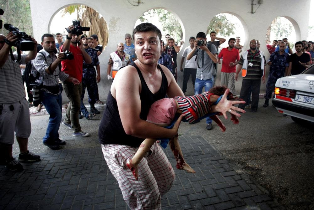 A Palestinian man carries the lifeless body of a child to an emergency room at Shifa hospital in Gaza. (AP)
