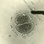 HMS_c161_IVF_1944_Specimen_2 (1)