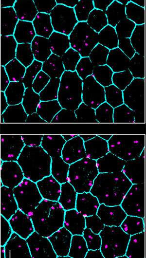 Recycling of the eye's light sensors is faulty in progressive blindness of older adults