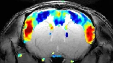 fMRI Rat Brain Signals