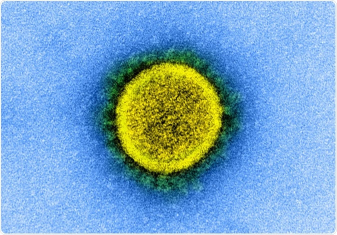 Novel Coronavirus SARS-CoV-2 Transmission electron micrograph of a SARS-CoV-2 virus particle, isolated from a patient. Image captured and color-enhanced at the NIAID Integrated Research Facility (IRF) in Fort Detrick, Maryland. Credit: NIAID