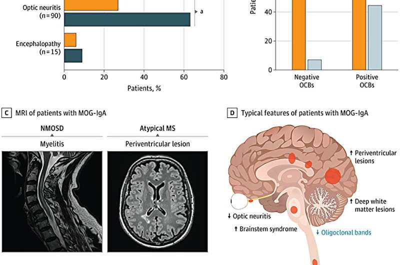 Possible biomarker of MS-like autoimmune disease discovered