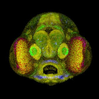 micrography image of a zebrafish head, which is shades of green and yellow with red dots in the "cheek" area.
