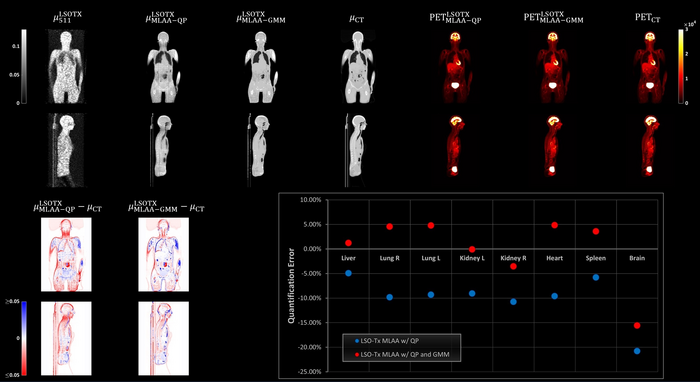 Attenuation maps with and without the use of CT images