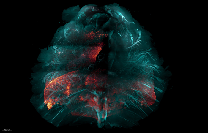 New method for making tissue transparent could speed the study of many diseases