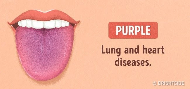 Màu tím: Bệnh về tim và phổi