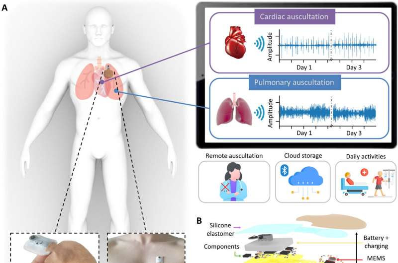 A soft wearable stethoscope designed for automated remote disease diagnosis