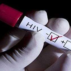 HIV resistant people, the clue for a new

treatment?