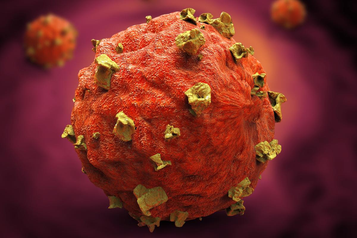 An artist's impression of a cancer cell