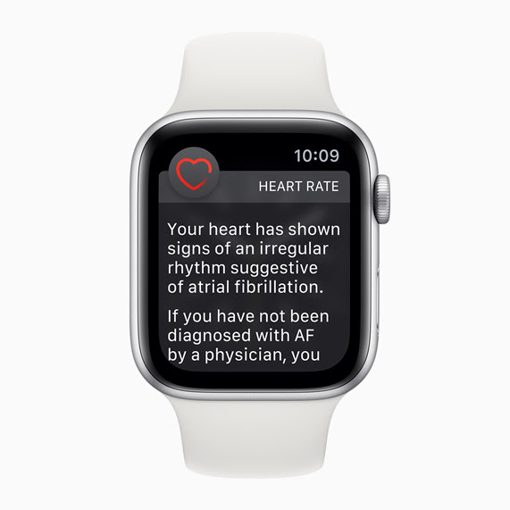 Apple Watch face with irregular heart rhythm notification.